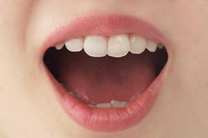 神戸でホワイトニングをしてみたいのなら